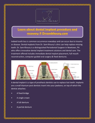 Learn about dental implant procedure and recovery @ Drsamkhoury.com