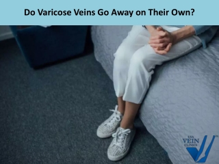 Do Varicose Veins Go Away on Their Own?