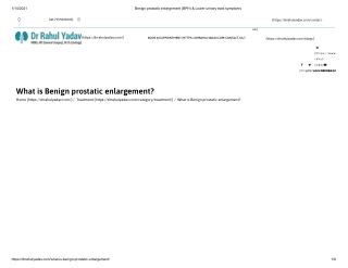 What is Benign prostatic enlargement?