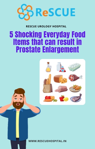 5 Shocking Everyday Food Items that can result in Prostate Enlargement-Prostate treatment in Kengeri | Prostate treatmen