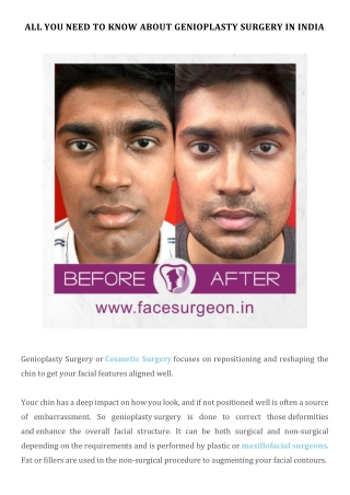 All you need to know about Genioplasty Surgery in India