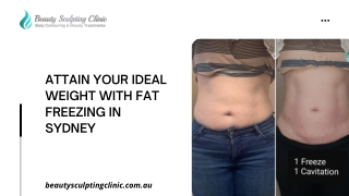 Attain your ideal weight with fat freezing in Sydney