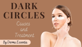 Dark Circles: Causes and Treatment by Derma Essentia
