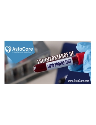The Importance of Lipid Profile Test