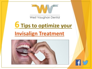 6 Tips to optimize your Invisalign Treatment