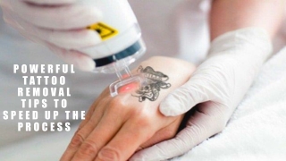 Powerful tattoo removal tips to speed up the process