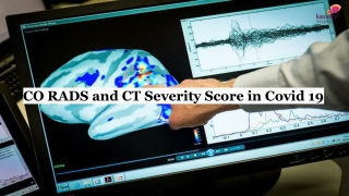 CO RADS and CT Severity Score in Covid 19
