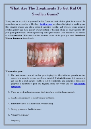 What Are The Treatments To Get Rid Of Swollen Gums?