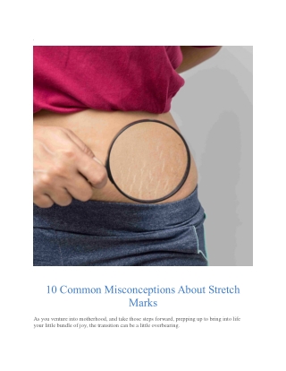 10 Common Misconceptions About Stretch Marks