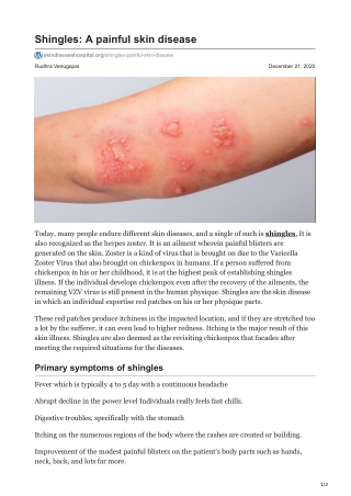 Shingles: A Painful Skin Disease | Skin Disease Hospital