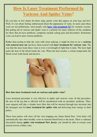 How Is Laser Treatment Performed In Varicose And Spider Veins?