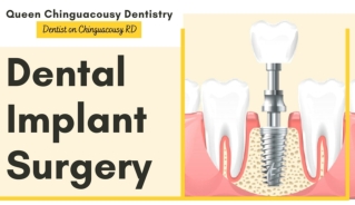 Dental Implant Surgery: What Is It?