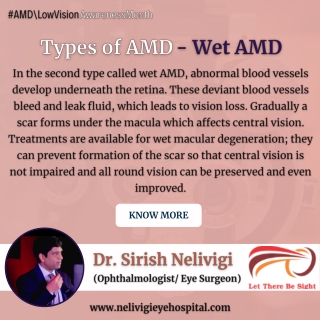 Know about Wet AMD | Best Eye Hospitals in Bellandur, Bangalore | Nelivigi Eye Hospital