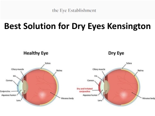 Best Solution for Dry Eyes Kensington