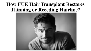 How FUE Hair Transplant Restores Thinning or Receding Hairline?