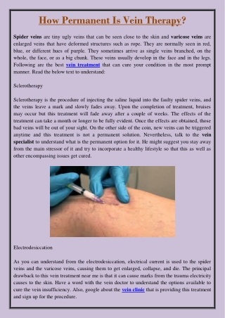 How Permanent Is Vein Therapy?