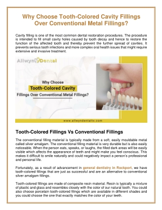 Cavity Fillings Is The Best Solution Over Conventional Metal Fillings