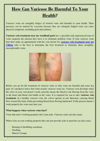 How Can Varicose Be Harmful To Your Health?