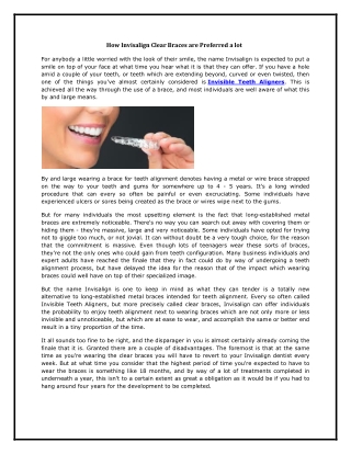 How Invisalign Clear Braces are Preferred a lot