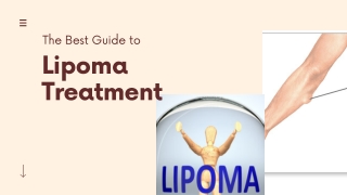 The Pain Relief Lipoma Treatment Naturally at Home