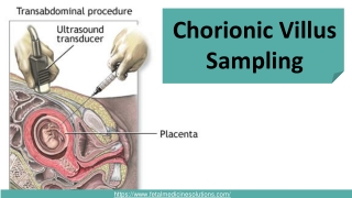 Chorionic Villus Sampling | Dr. Neha Gupta