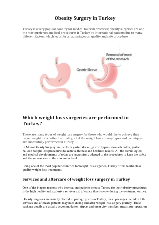 Obesity Surgery in Turkey