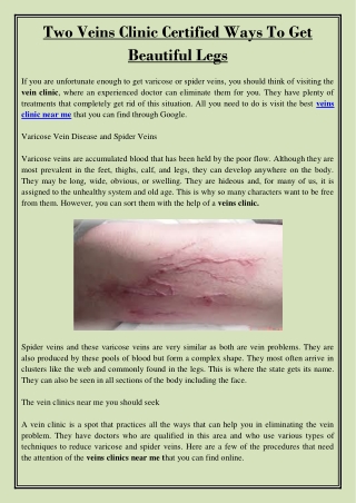 Two Veins Clinic Certified Ways To Get Beautiful Legs