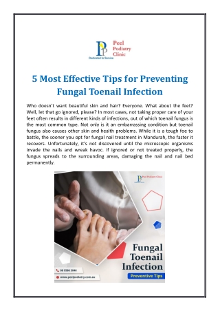 5 Most Effective Tips for Preventing Fungal Toenail Infection