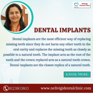 Dental Implants | Best Dental Clinic in Bellandur, Bangalore | Nelivigi Dental Clinic