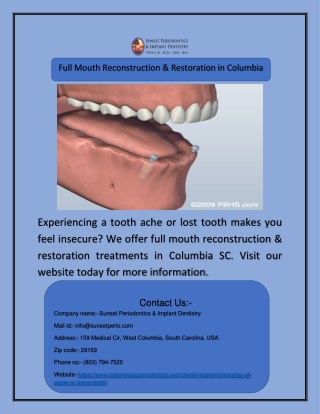 Full Mouth Reconstruction & Restoration in Columbia SC