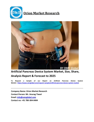 Artificial Pancreas Device System Market Trends, Size, Competitive Analysis and Forecast 2019-2025