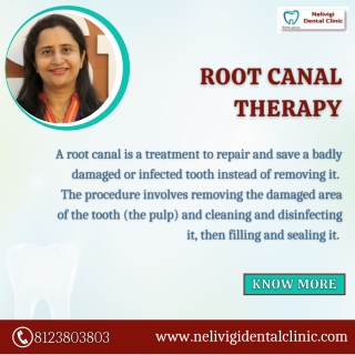 Root Canal Treatment - Best Dental Clinic in Bellandur, Bangalore - Nelivigi Dental Clinic