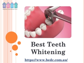 Best Teeth Whitening - (03 95788500) - BEDC