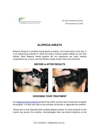 ALOPECIA AREATA