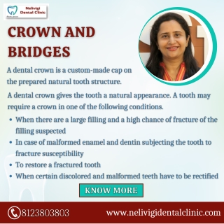 Crowns and Bridges | Best Dental Clinic in Bellandur, Bangalore | Nelivigi Dental Clinic