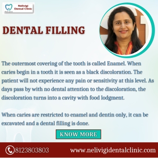 Dental Filling | Best Dental Clinic in Bellandur, Bangalore | Nelivigi Dental Clinic