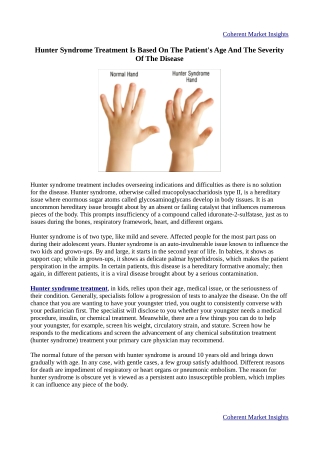 Hunter Syndrome Treatment Is Based On The Patient's Age And The Severity Of The Disease