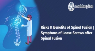 Symptoms of Loose Screws after Spinal Fusion | Orthopaedics and Spine specialist in UK