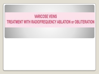 Varicose Veins Treatment with Radiofrequency Ablation or Obliteration