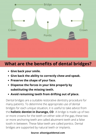 What are the benefits of dental bridges?