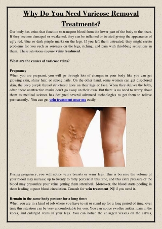 Why Do You Need Varicose Removal Treatments?