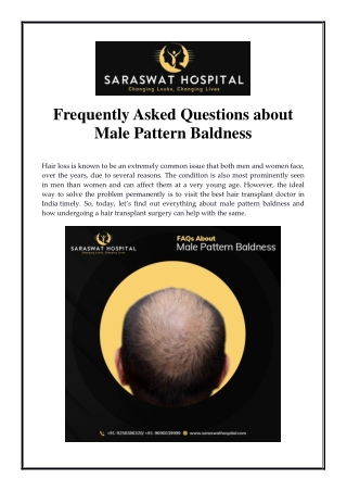 Frequently Asked Questions about Male Pattern Baldness