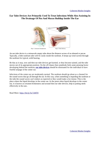 Ear Tube Devices Are Primarily Used To Treat Infections While Also Assisting In The Drainage Of Pus And Mucus Buildup In