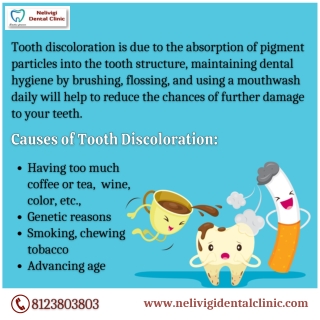 Causes of Tooth Discoloration | Best Dental Clinic in Bellandur, Bangalore | Nelivigi Dental Clinic