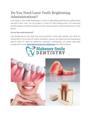 Teeth Whitening Service In Ballantyne | Blakeneysmiledentistry.com