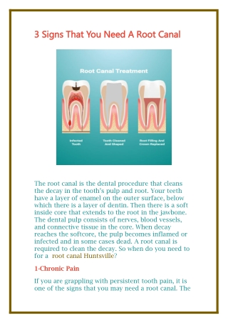 3 Signs That You Need A Root Canal