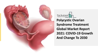 Polycystic Ovarian Syndrome Treatment Market Size, Growth, Trends and Research Analysis by TBRC