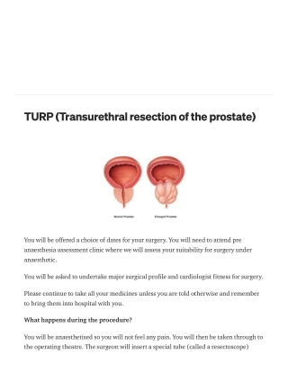 TURP (Transurethral resection of the prostate)