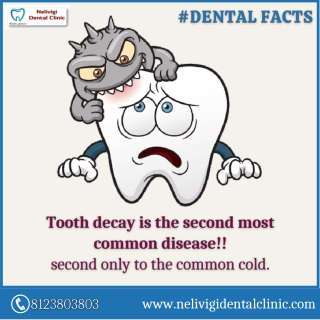 Tooth Decay - Best Dental Clinic in Bellandur, Bangalore - Nelivigi Dental Clinic