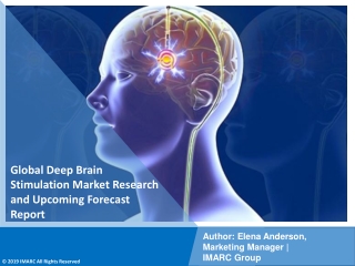 PDF- Deep Brain Stimulation Market: Research Report, Share, Size, Trends and Forecast by 2021-2026